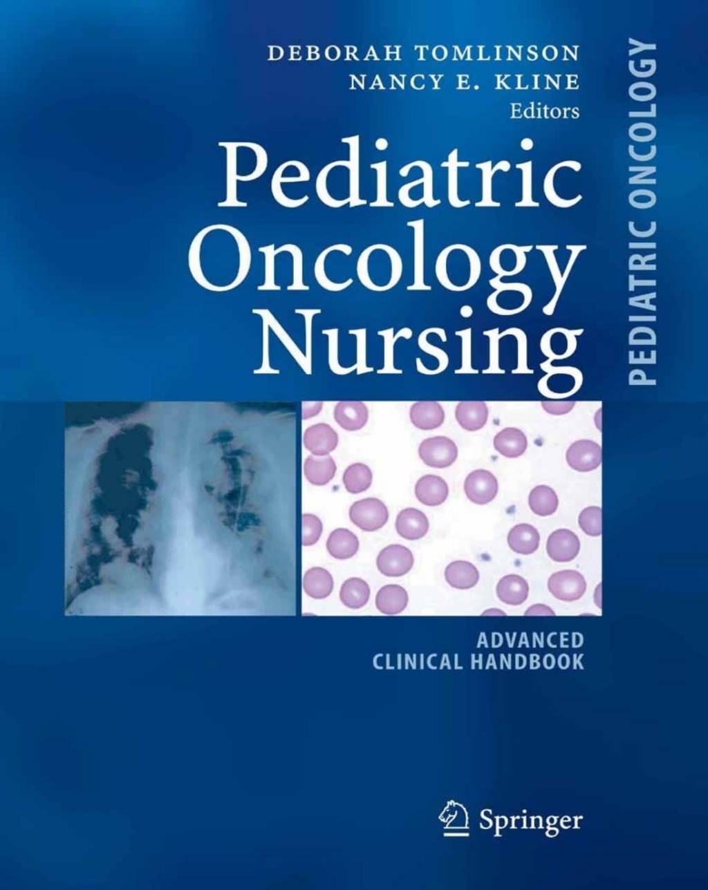 Pediatric Oncology Nursing Advanced Clinical Handbook  â€“ PDF/EPUB Version Downloadable