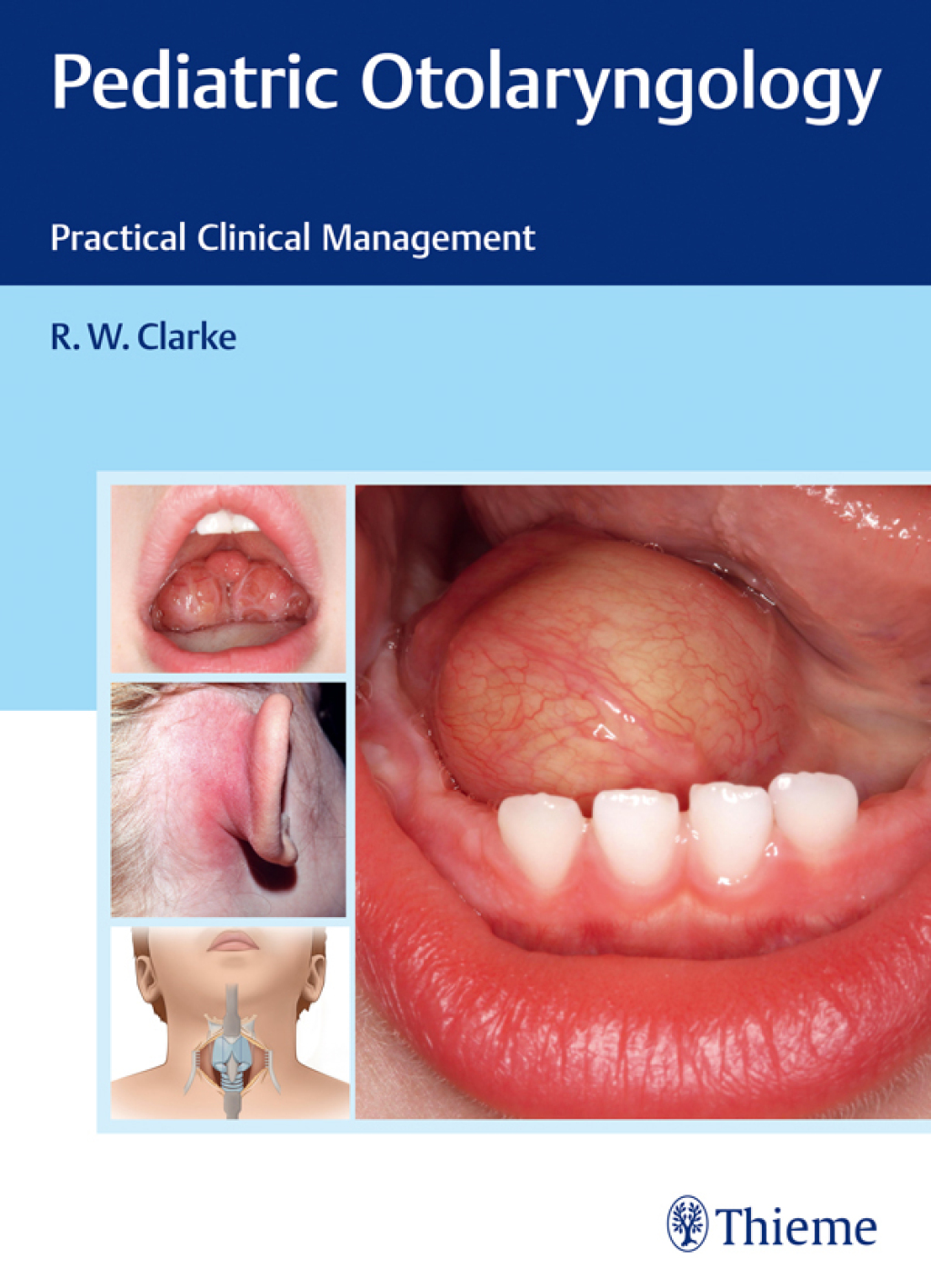 Pediatric Otolaryngology Practical Clinical Management 1st Edition â€“ PDF/EPUB Version Downloadable