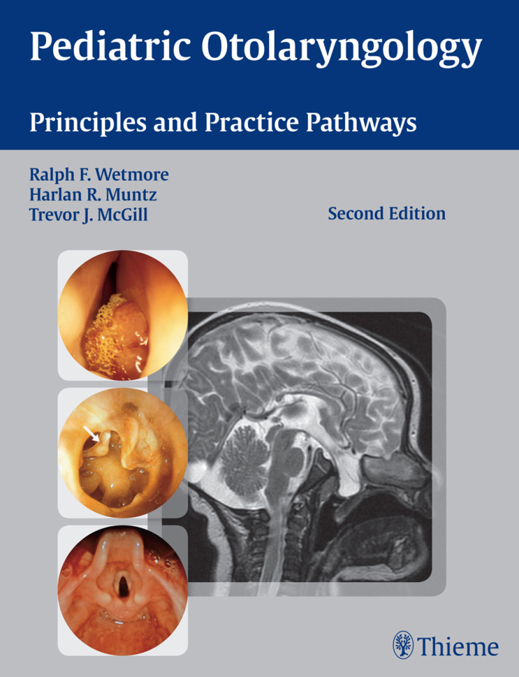 Pediatric Otolaryngology Principles and Practice Pathways 2nd Edition â€“ PDF/EPUB Version Downloadable