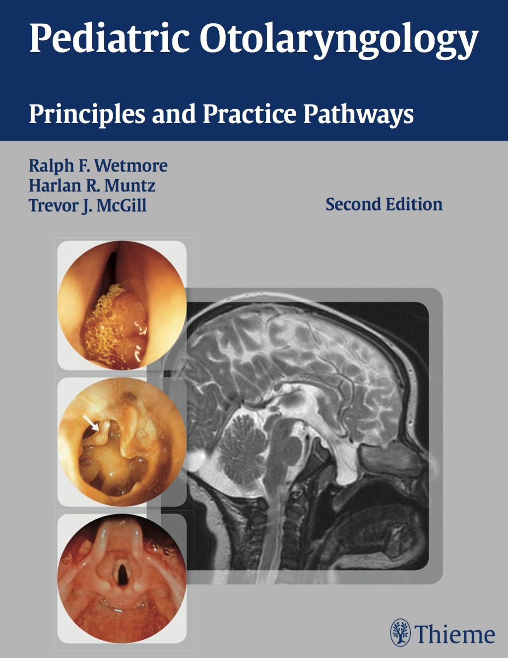 Pediatric Otolaryngology Principles and Practice Pathways 2nd Edition â€“ PDF/EPUB Version Downloadable