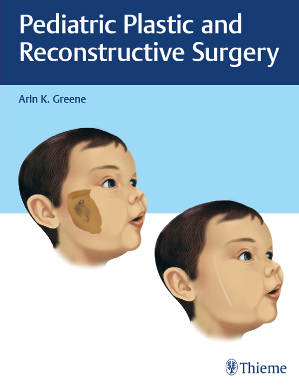 Pediatric Plastic and Reconstructive Surgery 1st Edition â€“ PDF/EPUB Version Downloadable