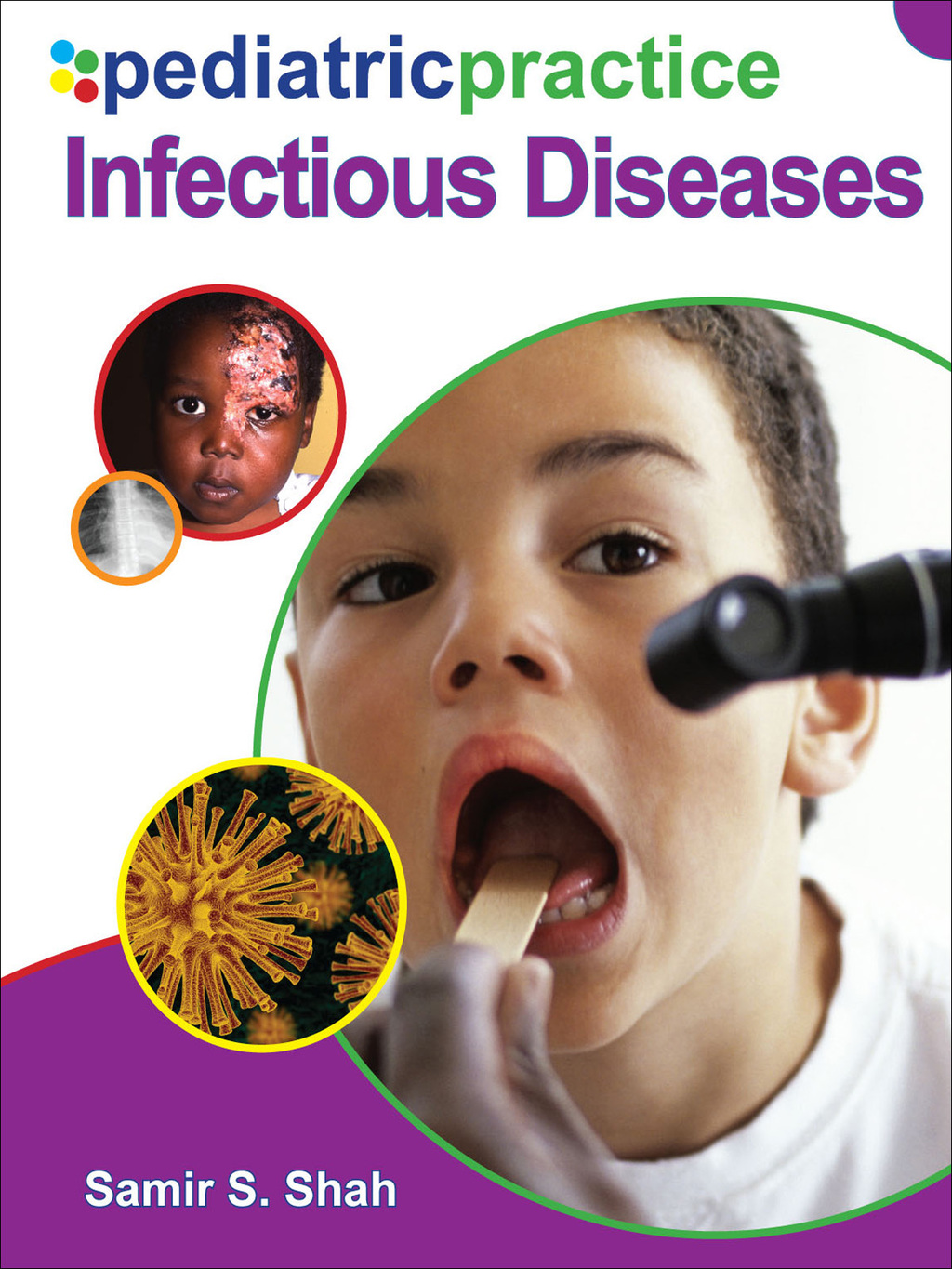 Pediatric Practice Infectious Diseases 1st Edition â€“ PDF/EPUB Version Downloadable