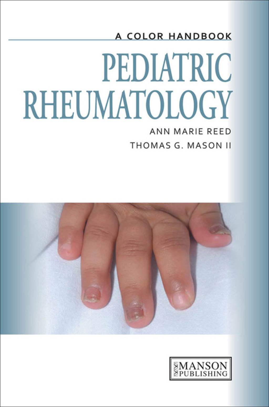 Pediatric Rheumatology A Color Handbook 1st Edition â€“ PDF/EPUB Version Downloadable