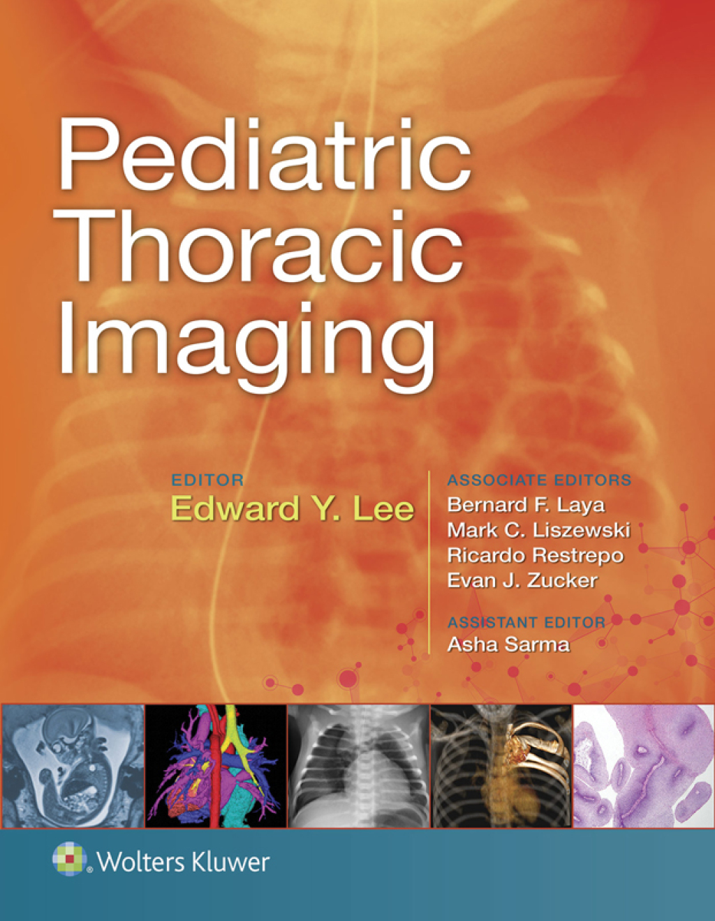 Pediatric Thoracic Imaging  â€“ PDF/EPUB Version Downloadable