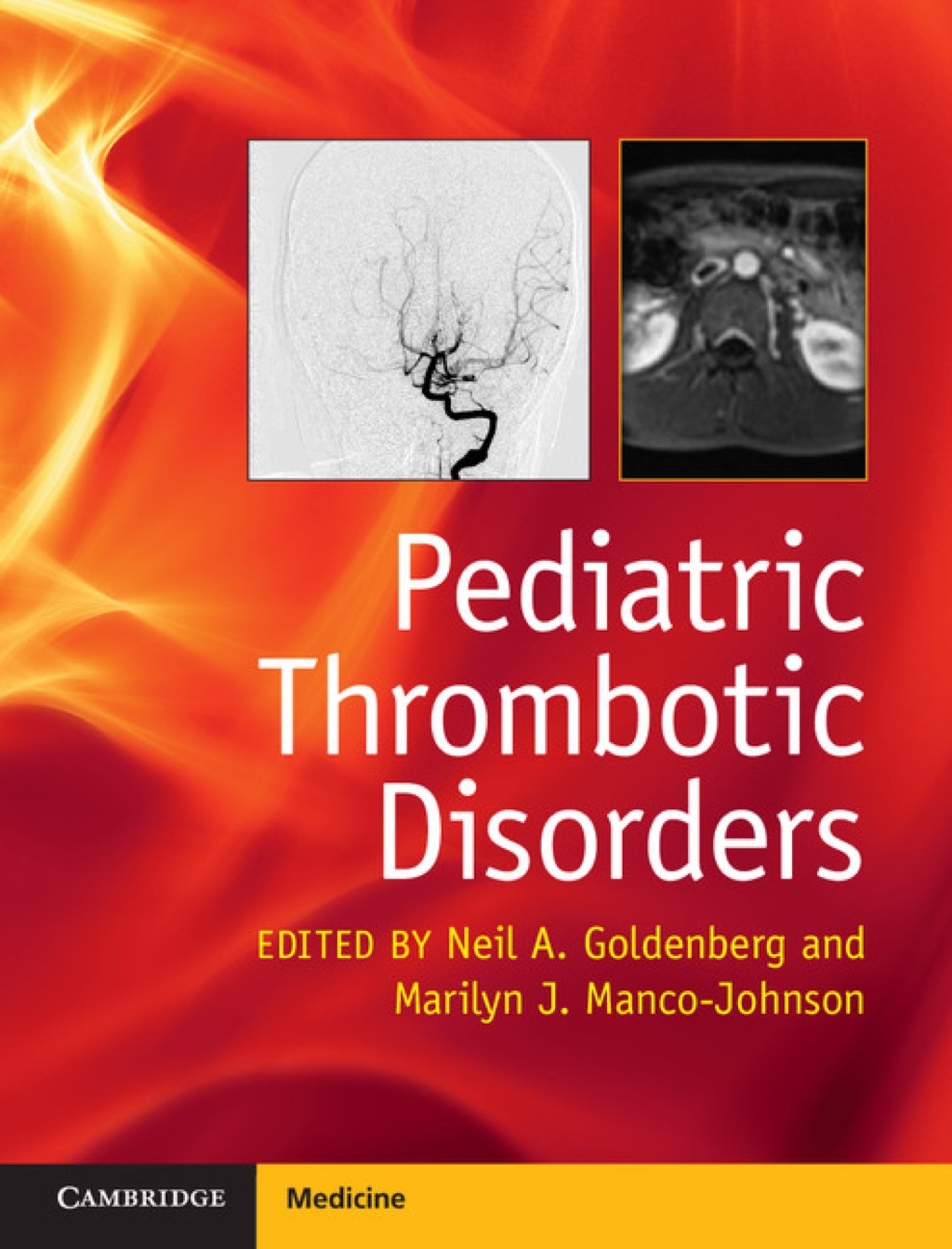 Pediatric Thrombotic Disorders 1st Edition â€“ PDF/EPUB Version Downloadable