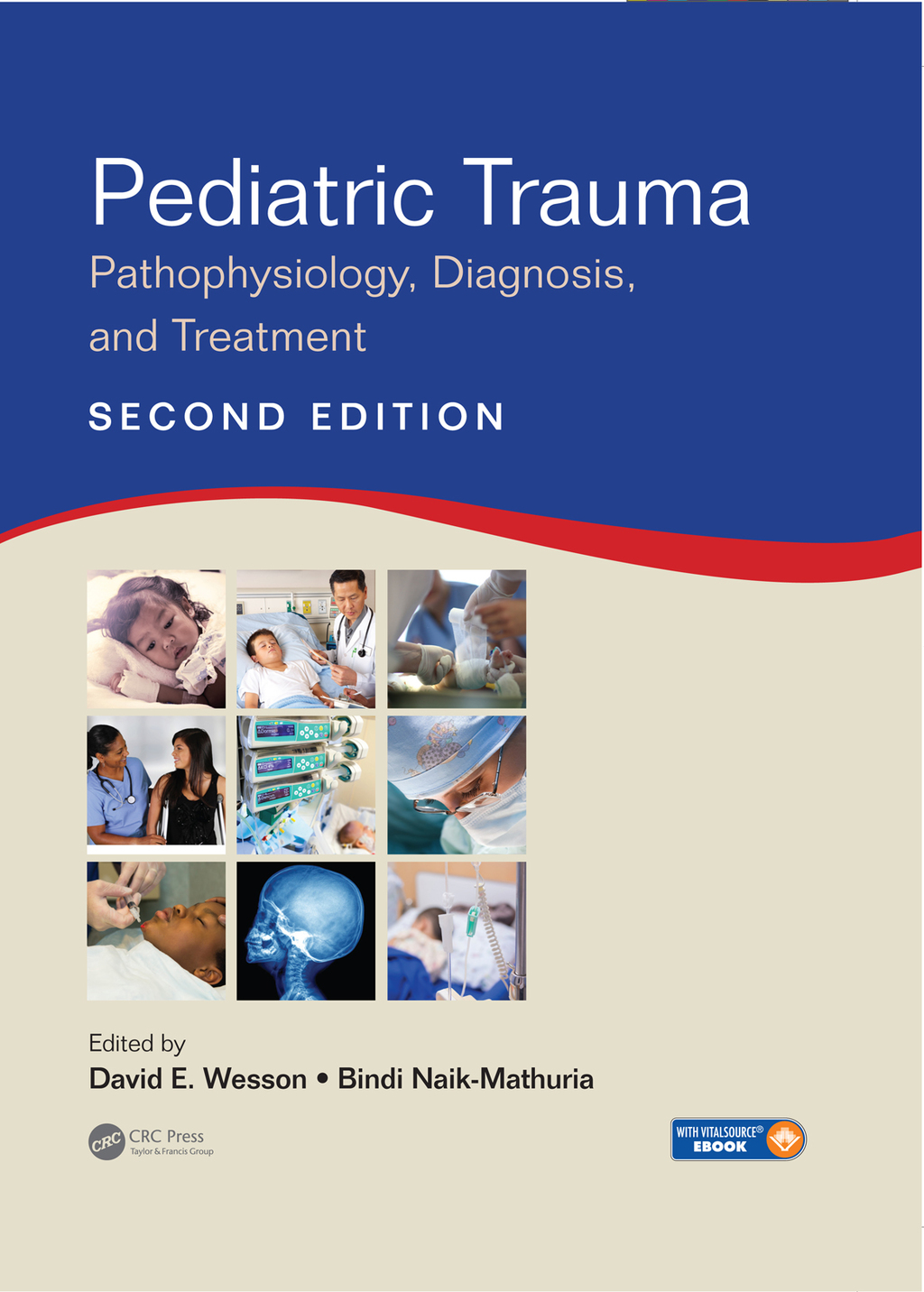 Pediatric Trauma Pathophysiology, Diagnosis, and Treatment, Second Edition 2nd Edition â€“ PDF/EPUB Version Downloadable