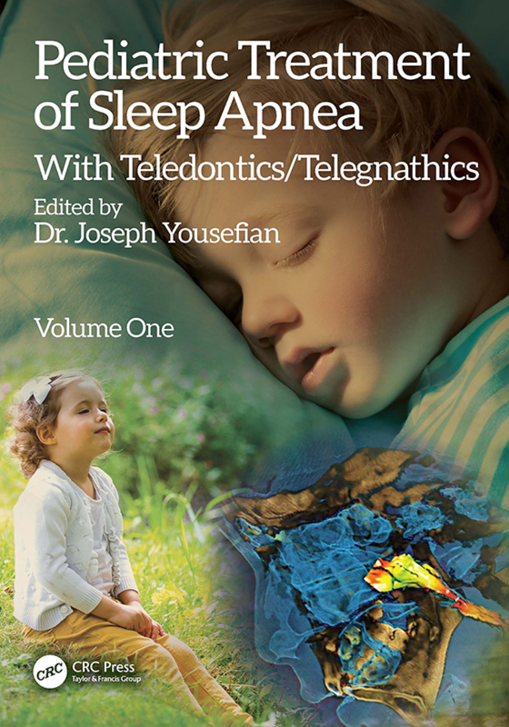 Pediatric Treatment of Sleep Apnea With Teledontics/Telegnathics 1st Edition â€“ PDF/EPUB Version Downloadable