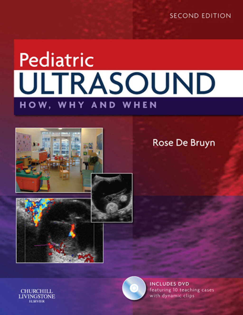 Pediatric Ultrasound How, Why and When 2nd Edition â€“ PDF/EPUB Version Downloadable