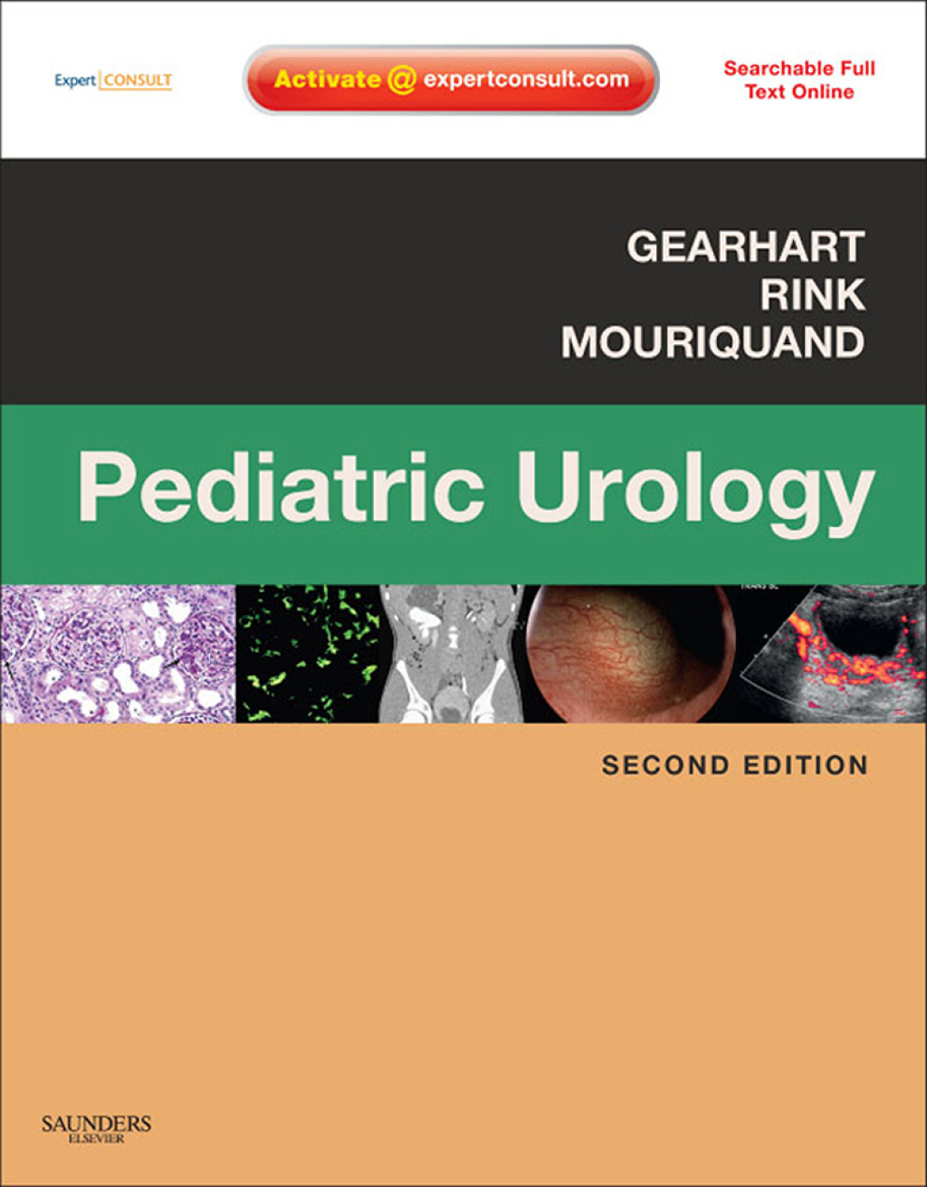 Pediatric Urology - Electronic 2nd Edition â€“ PDF/EPUB Version Downloadable