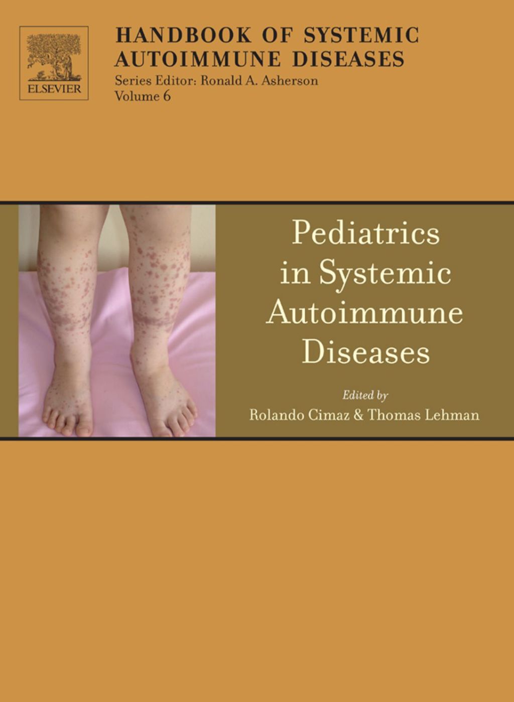 Pediatrics in Systemic Autoimmune Diseases  â€“ PDF/EPUB Version Downloadable
