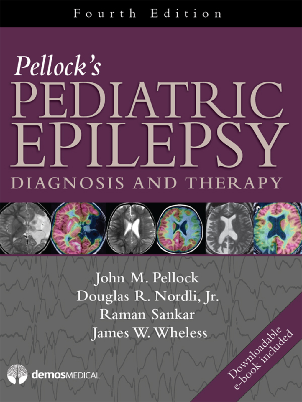 Pellock's Pediatric Epilepsy Diagnosis and Therapy 4th Edition â€“ PDF/EPUB Version Downloadable
