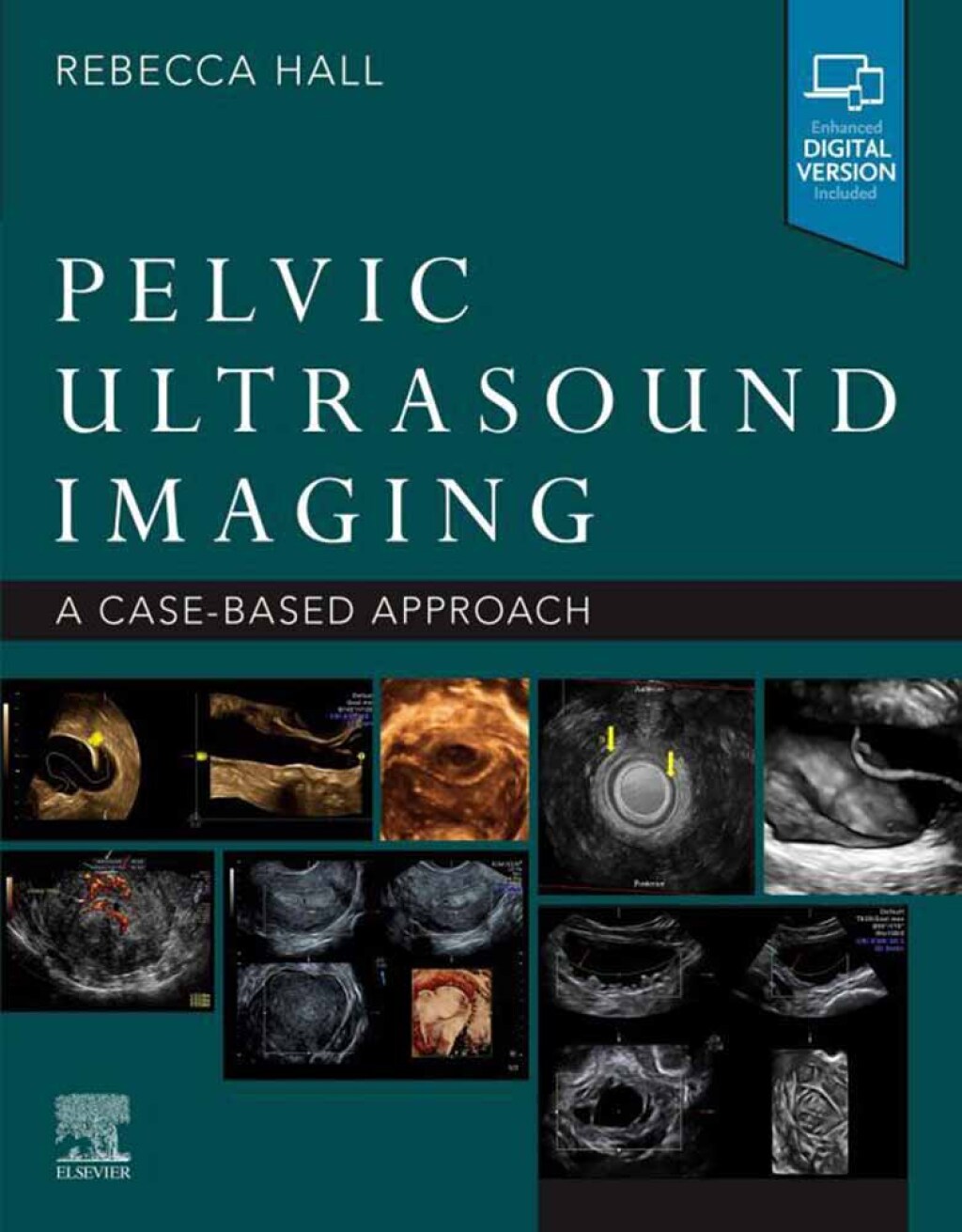 Pelvic Ultrasound Imaging A Cased-Based Application  â€“ PDF/EPUB Version Downloadable