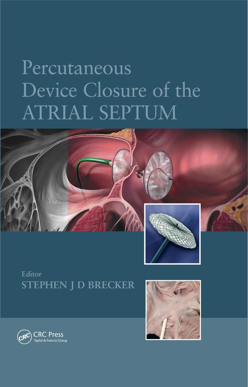 Percutaneous Device Closure of the Atrial Septum 1st Edition â€“ PDF/EPUB Version Downloadable