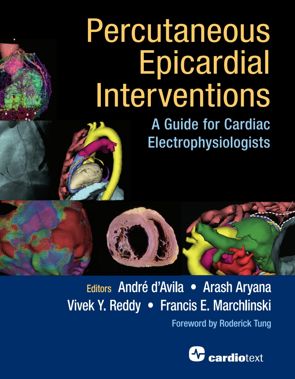 Percutaneous Epicardial Interventions: A Guide for Cardiac Electrophysiologists 1st Edition â€“ PDF/EPUB Version Downloadable