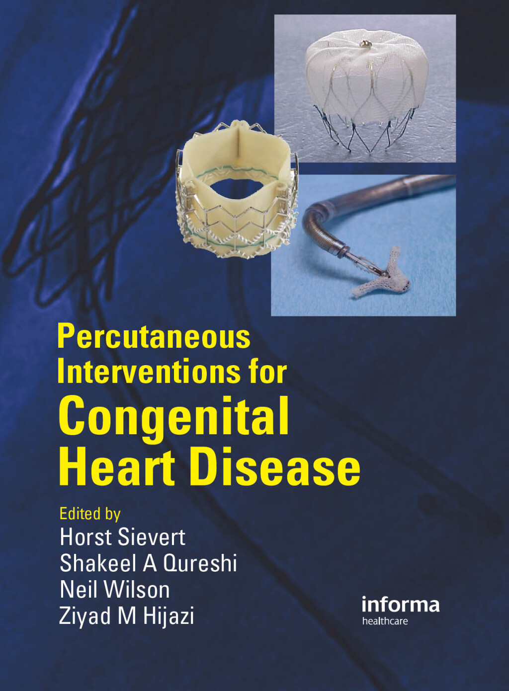 Percutaneous Interventions for Congenital Heart Disease 1st Edition â€“ PDF/EPUB Version Downloadable