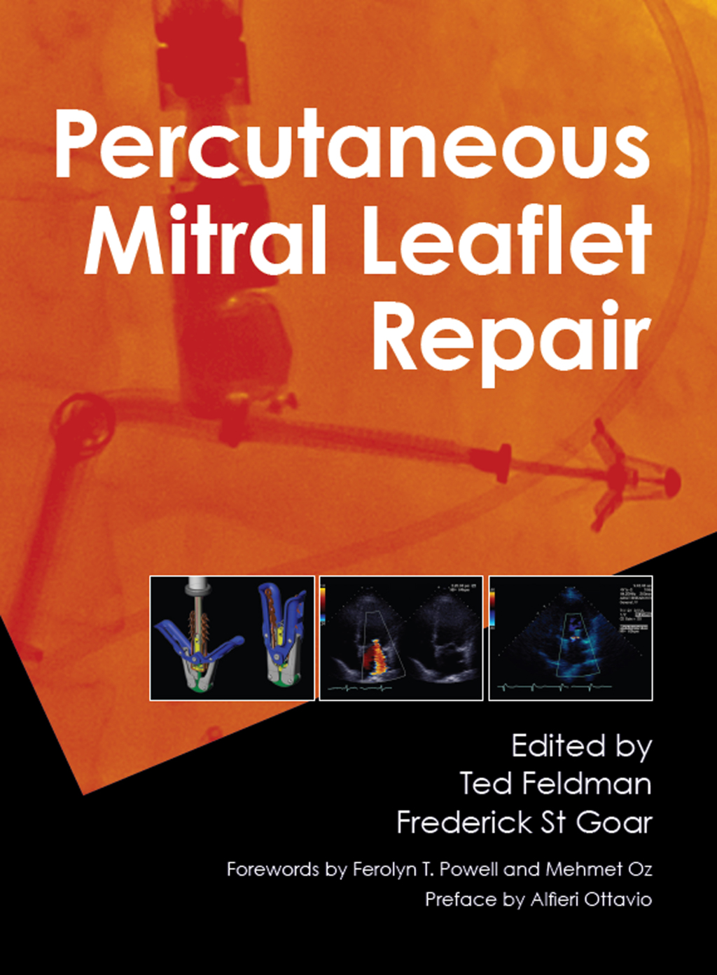 Percutaneous Mitral Leaflet Repair MitraClip Therapy for Mitral Regurgitation 1st Edition â€“ PDF/EPUB Version Downloadable