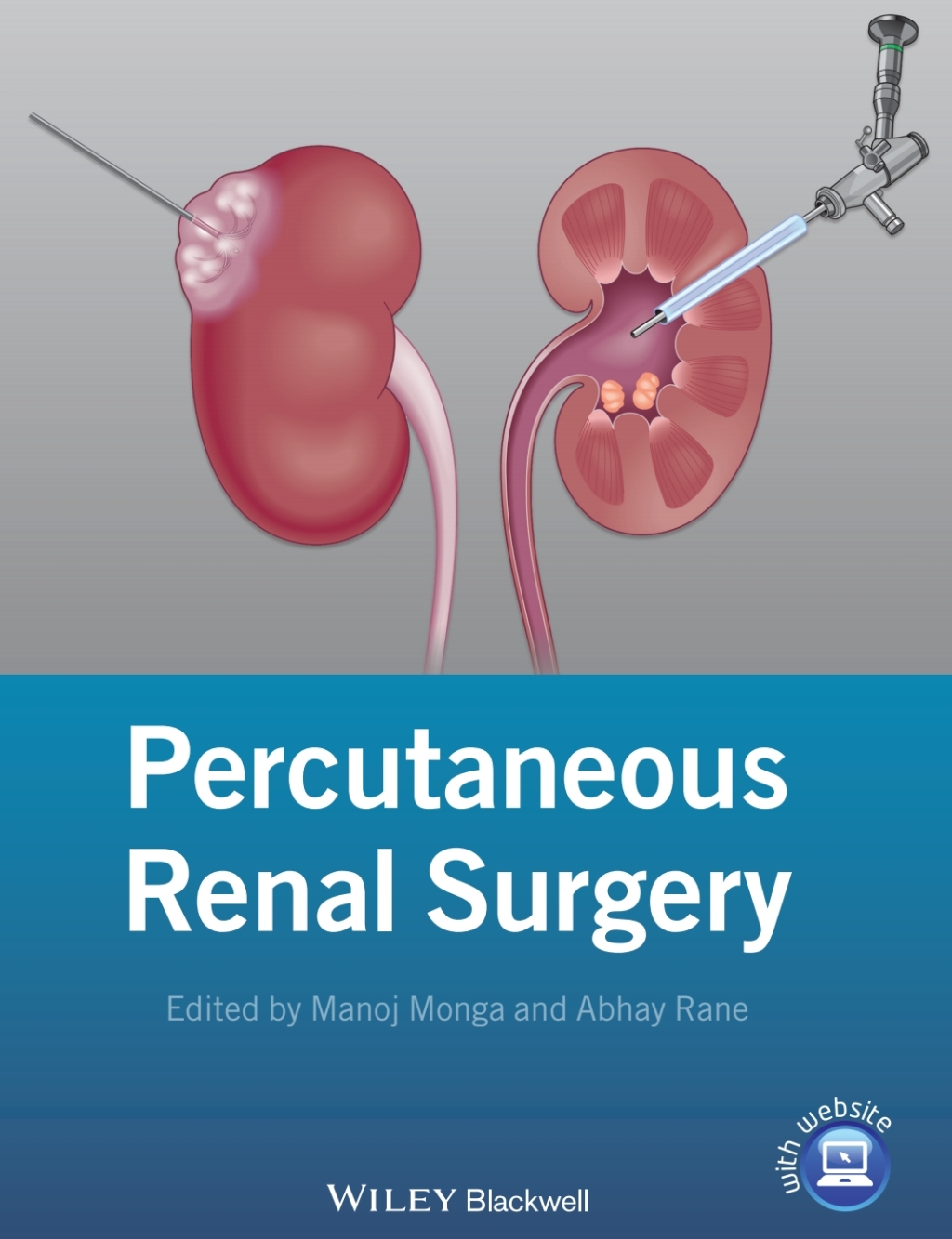 Percutaneous Renal Surgery 1st Edition â€“ PDF/EPUB Version Downloadable