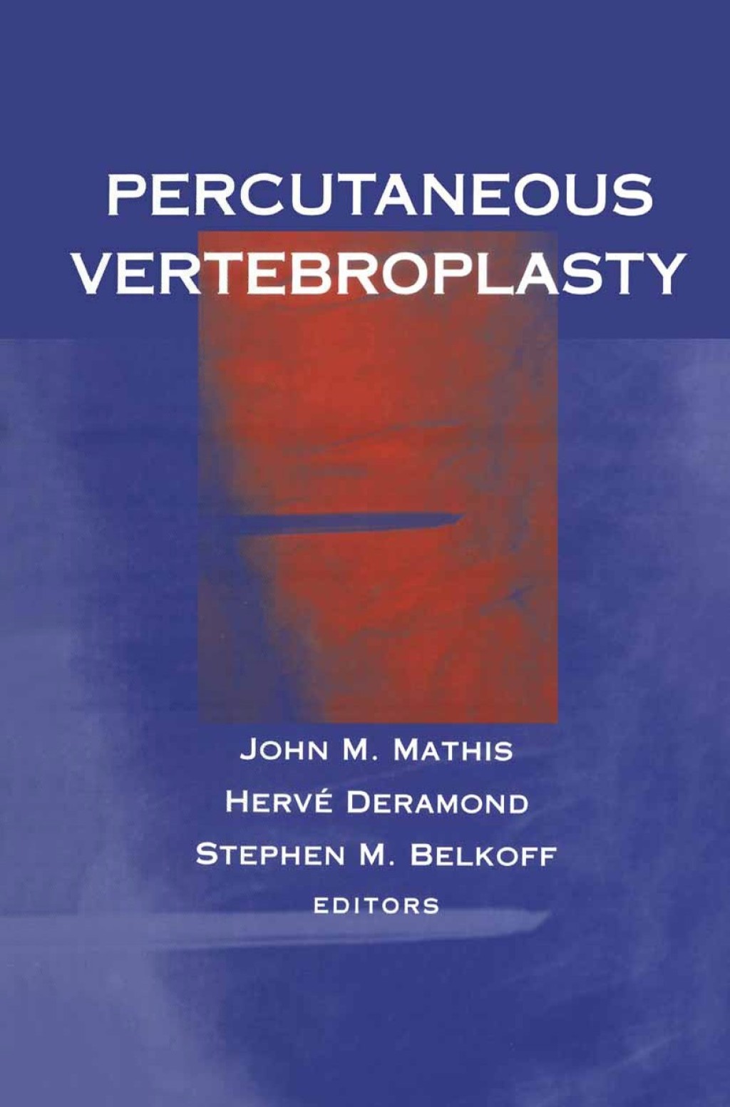 Percutaneous Vertebroplasty 1st Edition â€“ PDF/EPUB Version Downloadable
