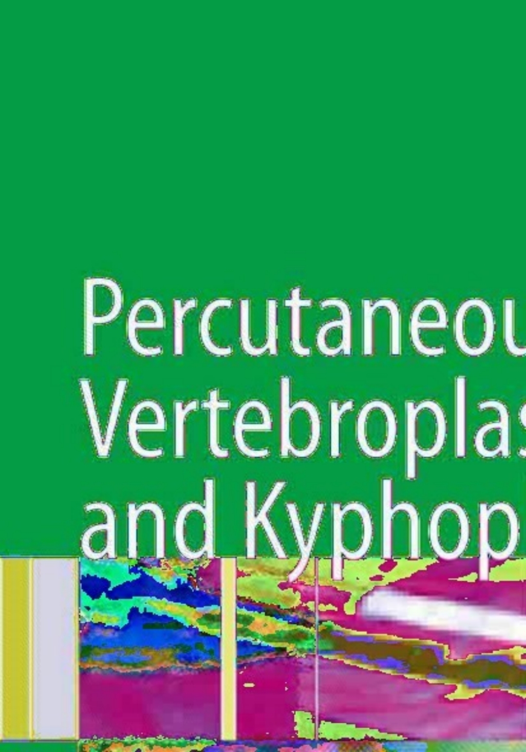 Percutaneous Vertebroplasty and Kyphoplasty 2nd Edition â€“ PDF/EPUB Version Downloadable