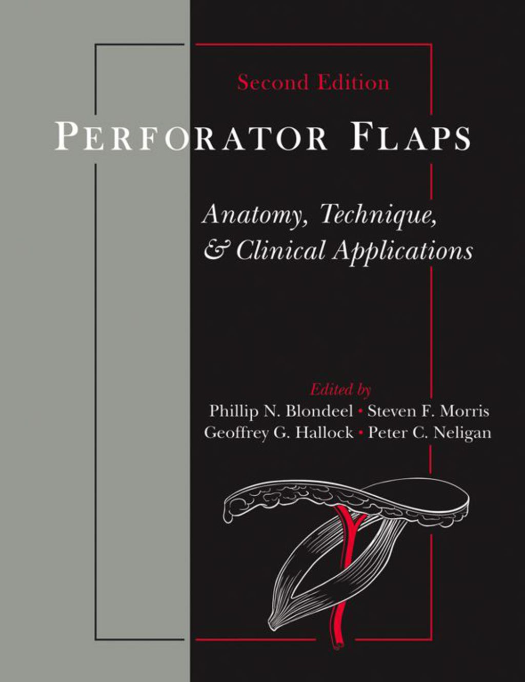 Perforator Flaps 2nd Edition â€“ PDF/EPUB Version Downloadable