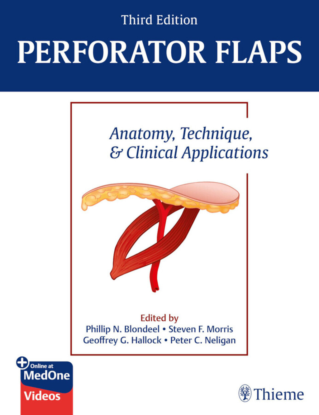 Perforator Flaps Anatomy, Technique, & Clinical Applications 3rd Edition â€“ PDF/EPUB Version Downloadable