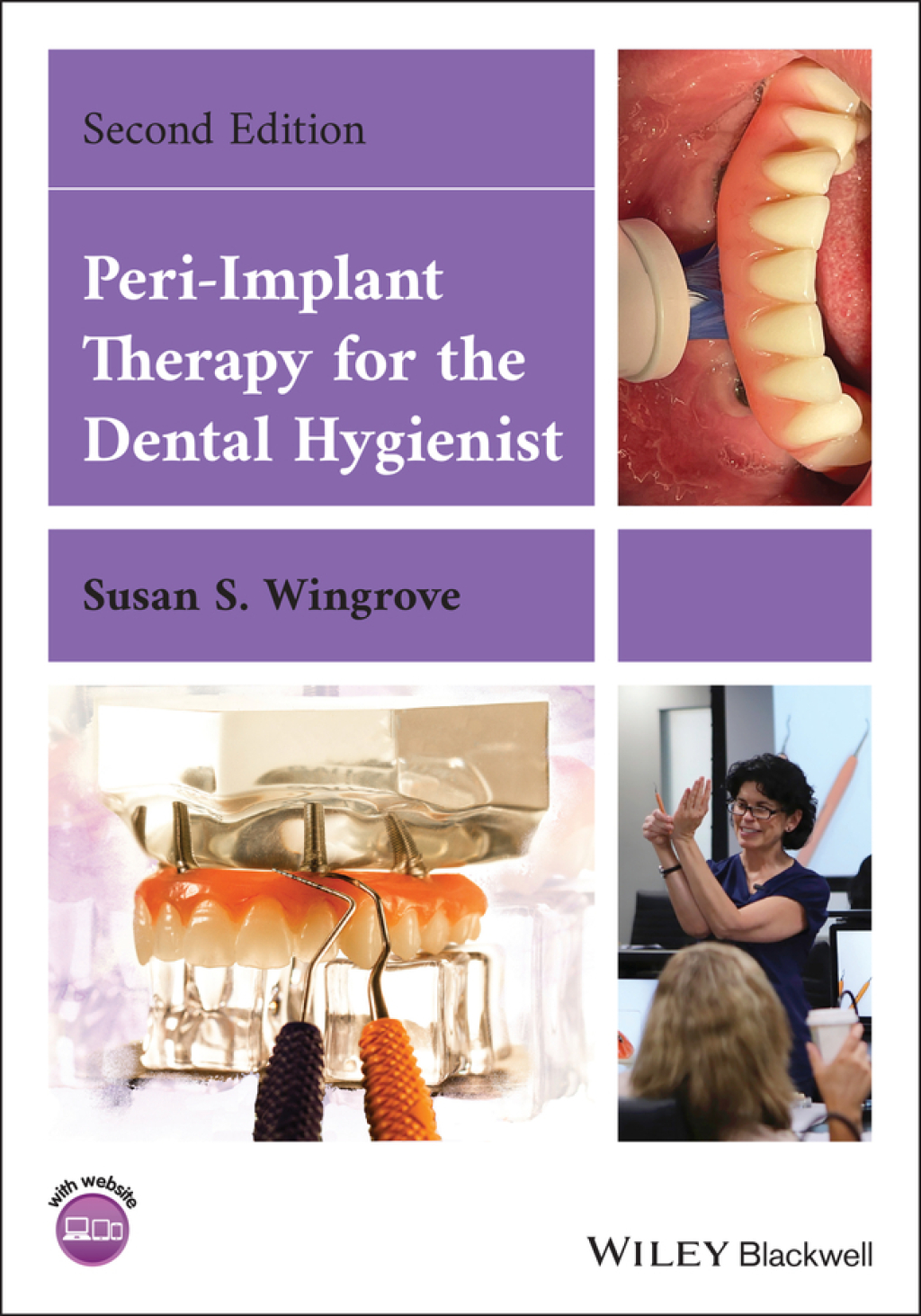 Peri-Implant Therapy for the Dental Hygienist 2nd Edition â€“ PDF/EPUB Version Downloadable
