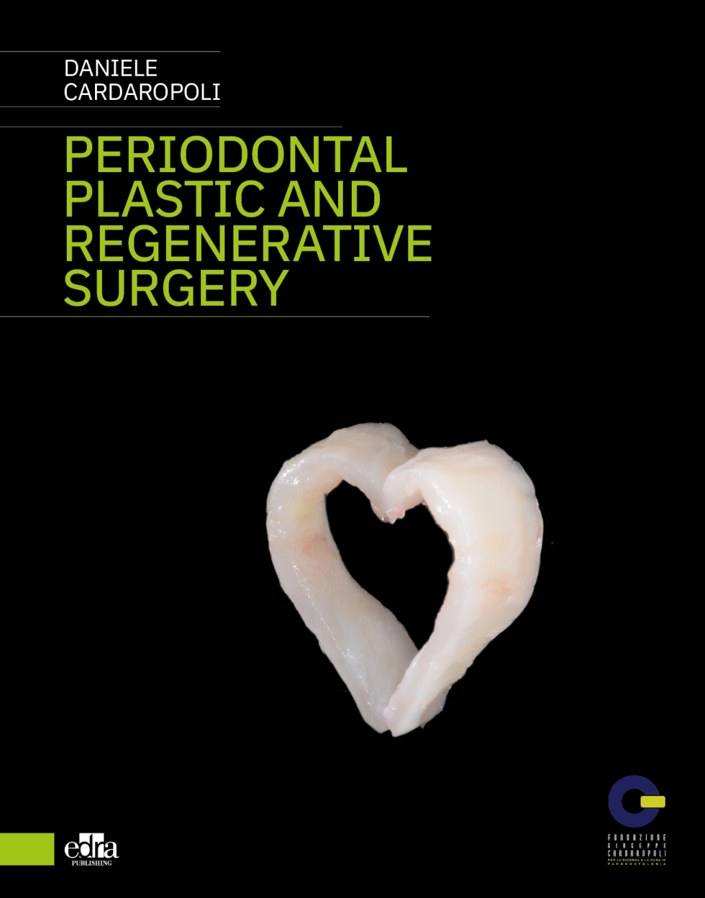 Peridontal plastic and regenerative surgery 1st Edition â€“ PDF/EPUB Version Downloadable