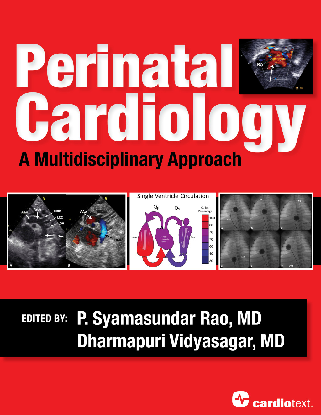 Perinatal Cardiology: A Multidisciplinary Approach A Multidisciplinary Approach 1st Edition â€“ PDF/EPUB Version Downloadable