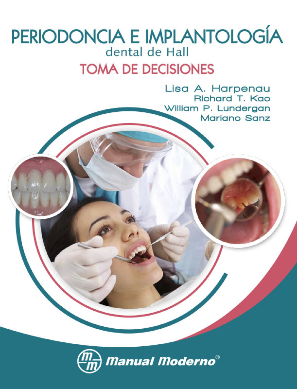 Periodoncia e implantologiÌa dental de Hall. Toma de decisiones 1st Edition â€“ PDF/EPUB Version Downloadable