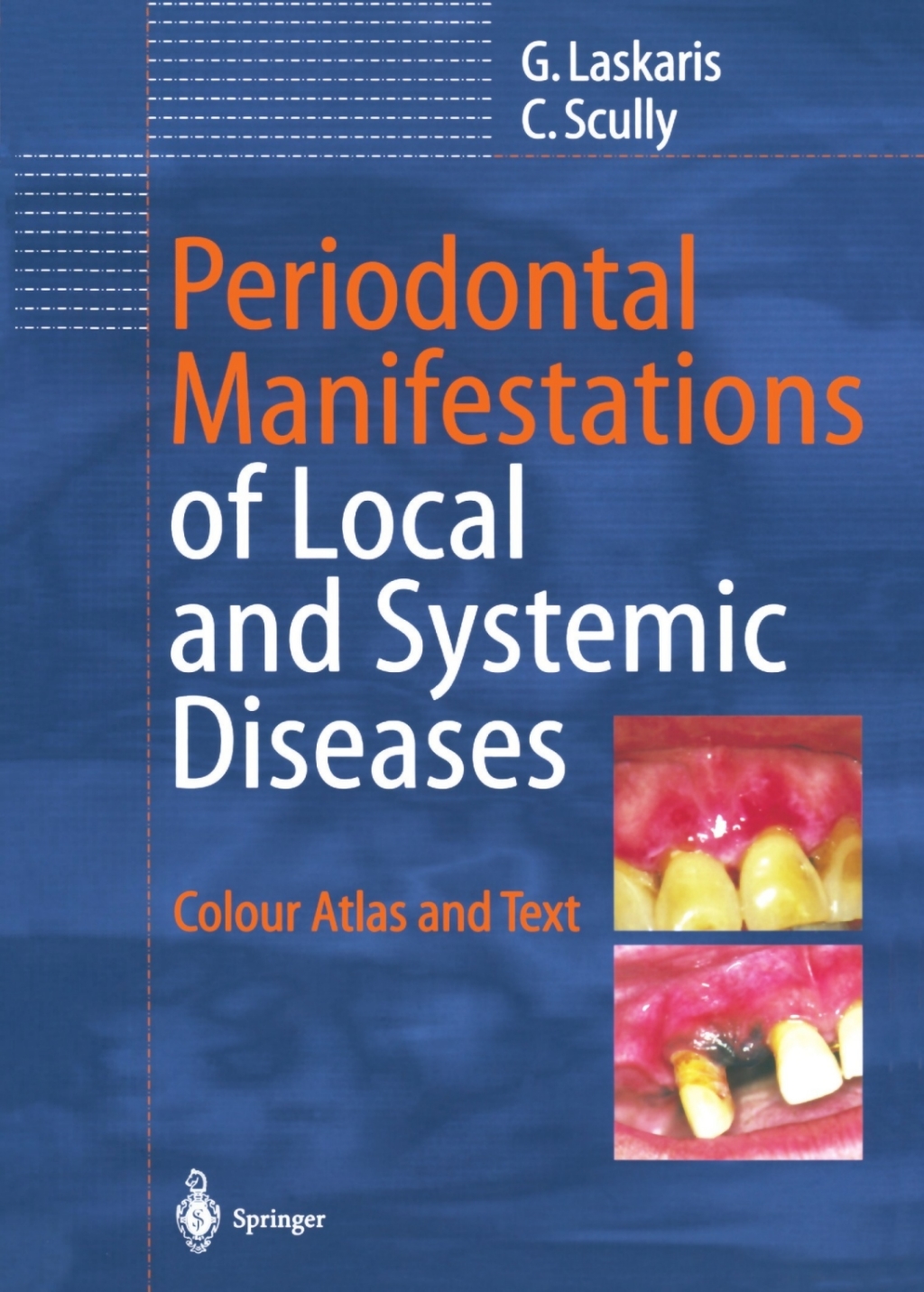 Periodontal Manifestations of Local and Systemic Diseases Colour Atlas and Text  â€“ PDF/EPUB Version Downloadable