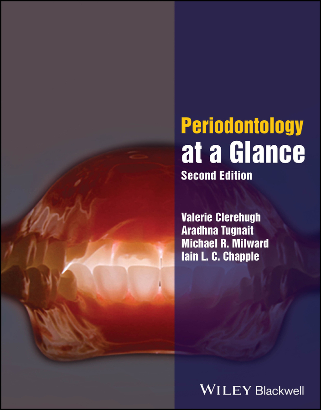 Periodontology at a Glance 2nd Edition - (PDF/EPUB Version)