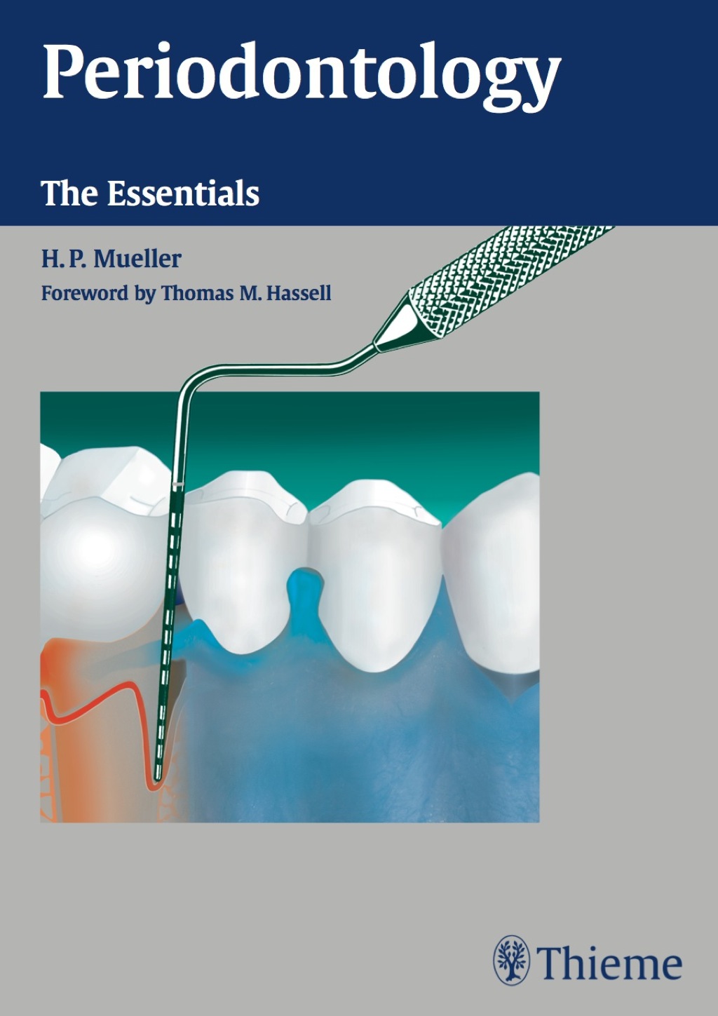 Periodontology The Essentials 1st Edition â€“ PDF/EPUB Version Downloadable
