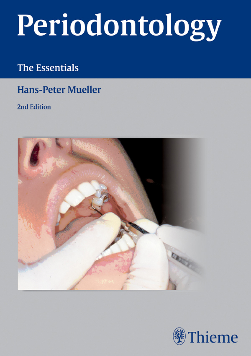 Periodontology The Essentials 2nd Edition â€“ PDF/EPUB Version Downloadable