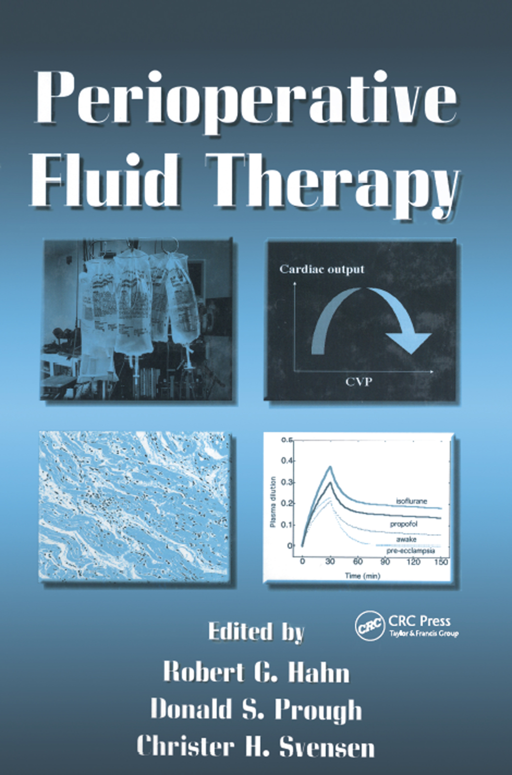 Perioperative Fluid Therapy 1st Edition â€“ PDF/EPUB Version Downloadable