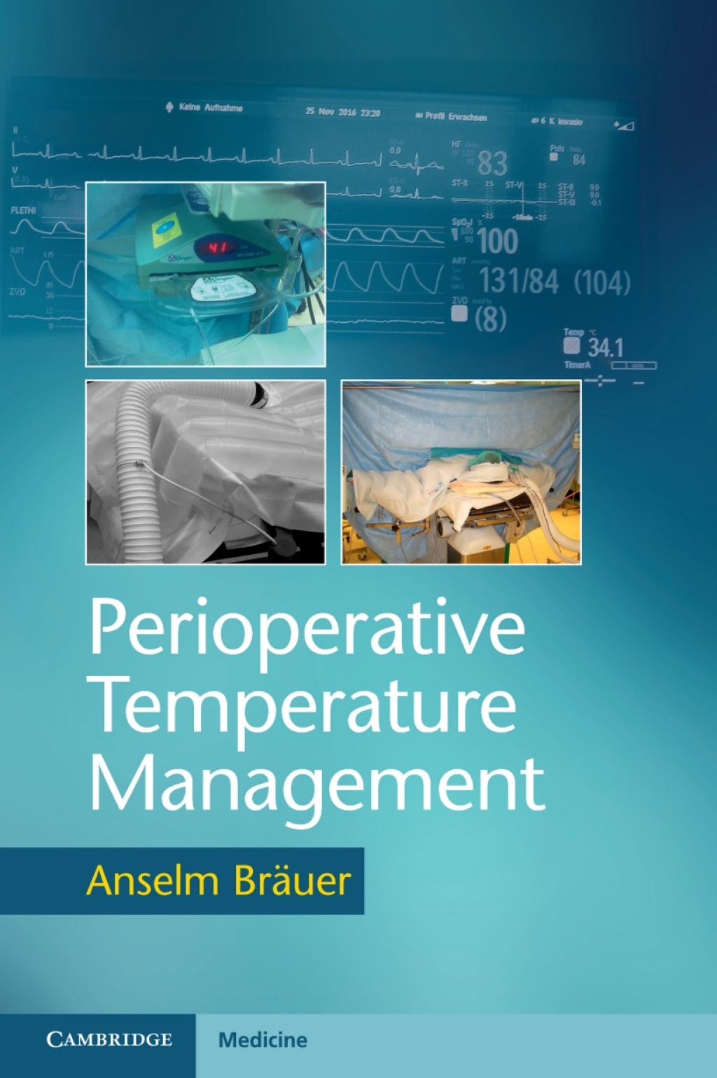 Perioperative Temperature Management – PDF/EPUB Version Downloadable Perioperative Temperature Management – PDF/EPUB Version Downloadable - Image 1