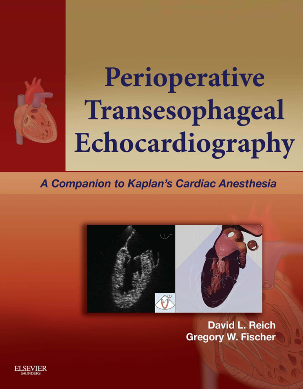 Perioperative Transesophageal Echocardiography A Companion to Kaplanâ€™s Cardiac Anesthesia  â€“ PDF/EPUB Version Downloadable