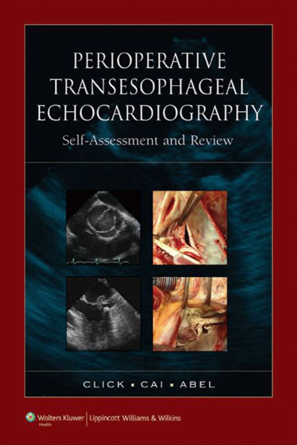 Perioperative Transesophageal Echocardiography Self-Assessment and Review 1st Edition â€“ PDF/EPUB Version Downloadable