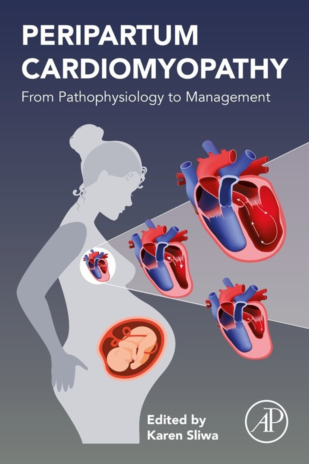 Peripartum Cardiomyopathy From Pathophysiology to Management  â€“ PDF/EPUB Version Downloadable