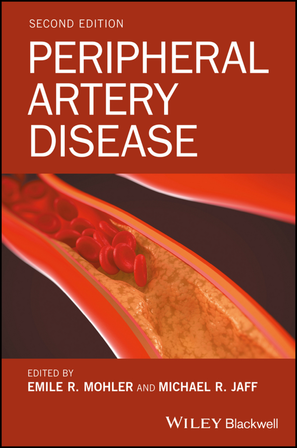 Peripheral Artery Disease 2nd Edition â€“ PDF/EPUB Version Downloadable