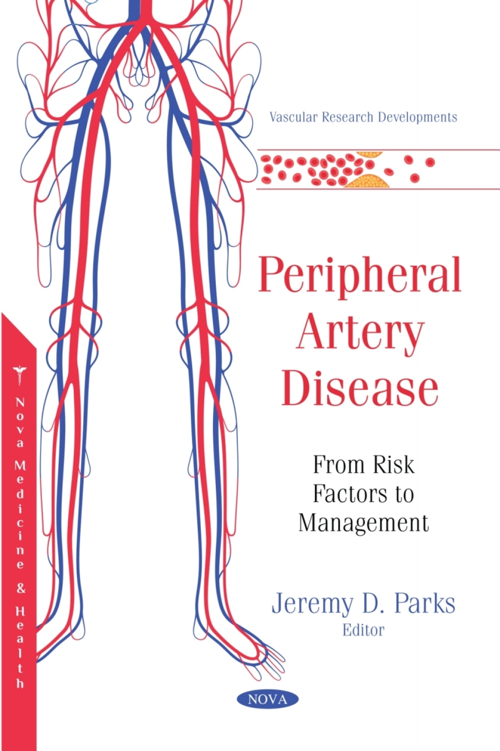 Peripheral Artery Disease: From Risk Factors to Management  â€“ PDF/EPUB Version Downloadable