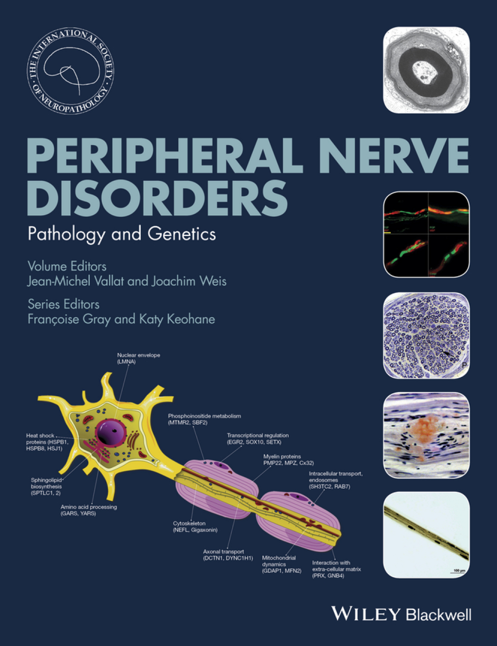 Peripheral Nerve Disorders Pathology and Genetics 1st Edition â€“ PDF/EPUB Version Downloadable