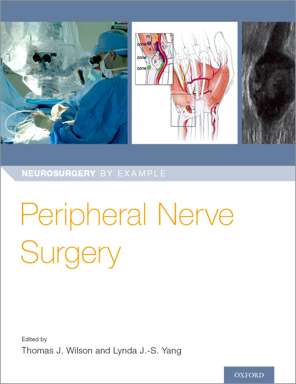 Peripheral Nerve Surgery 1st Edition â€“ PDF/EPUB Version Downloadable