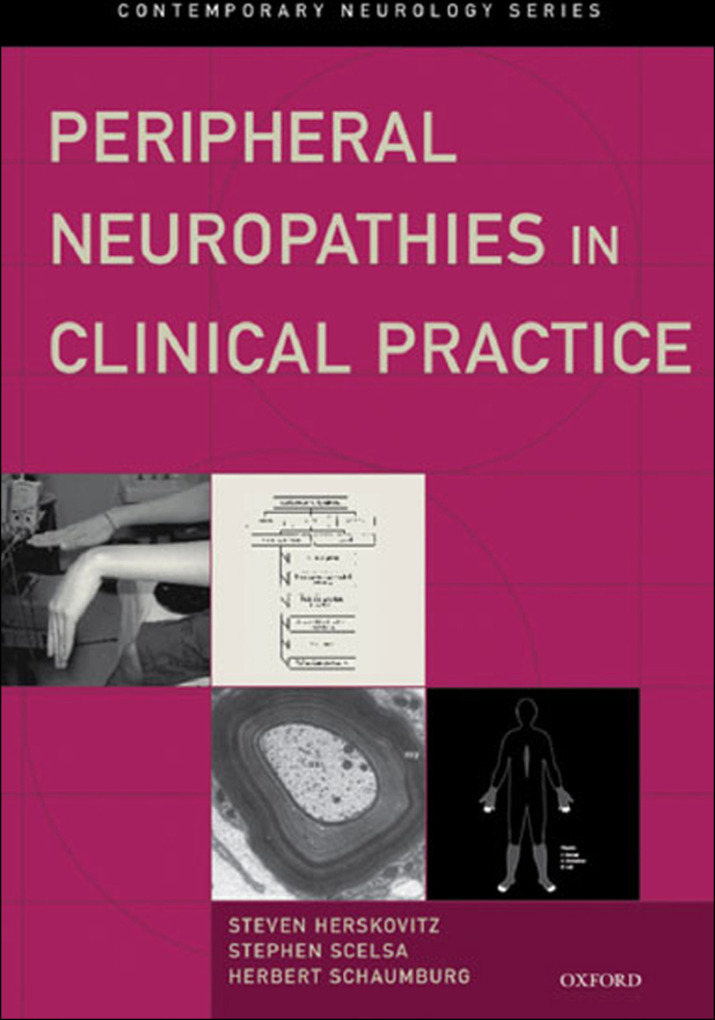 Peripheral Neuropathies in Clinical Practice  â€“ PDF/EPUB Version Downloadable
