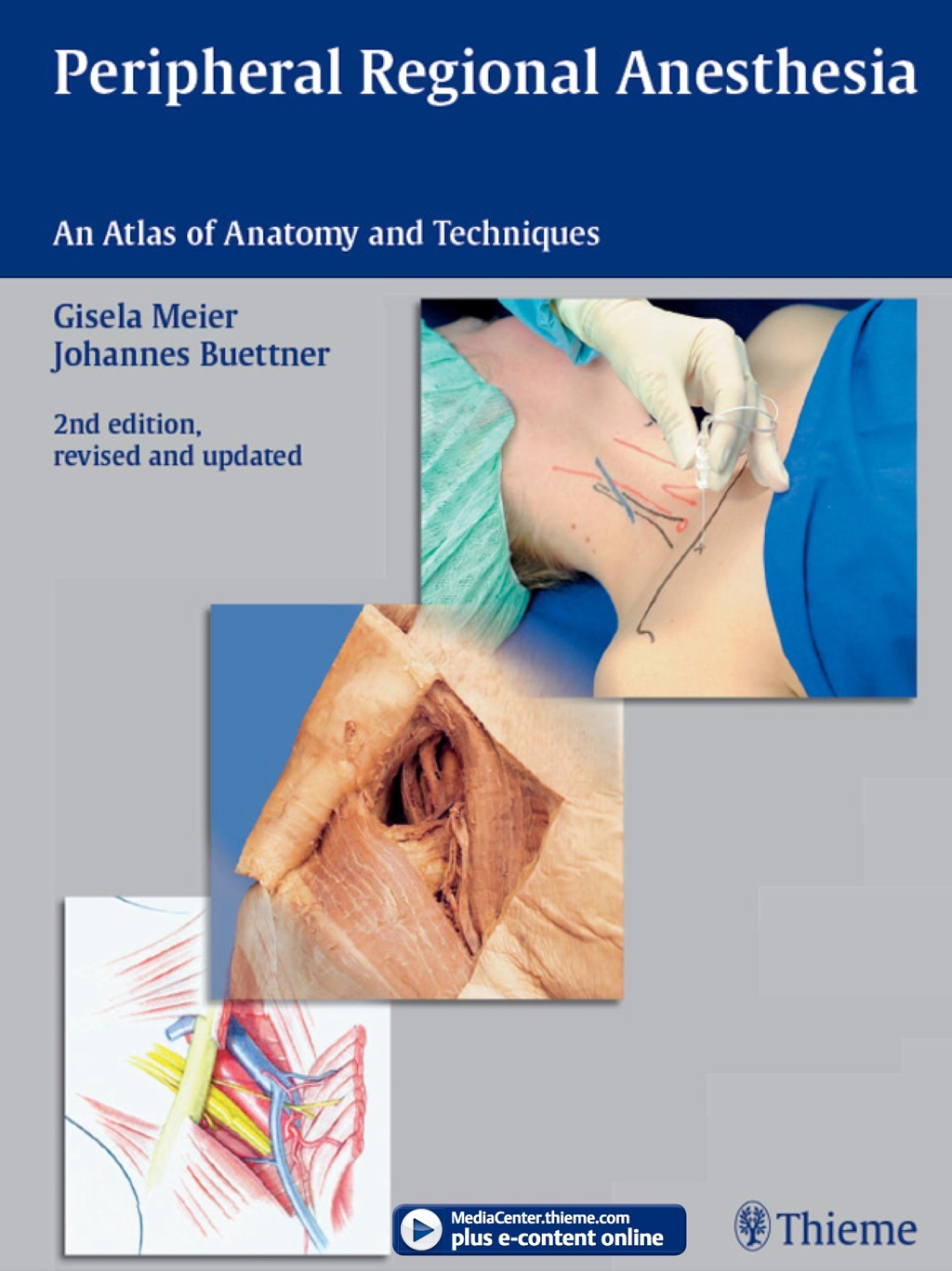 Peripheral Regional Anesthesia An Atlas of Anatomy and Techniques 2nd Edition â€“ PDF/EPUB Version Downloadable