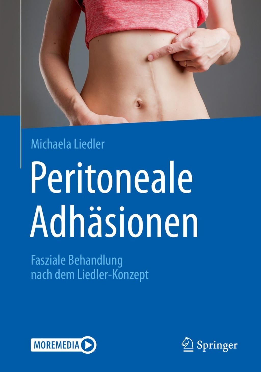Peritoneale AdhÃ¤sionen Fasziale Behandlung nach dem Liedler-Konzept  â€“ PDF/EPUB Version Downloadable