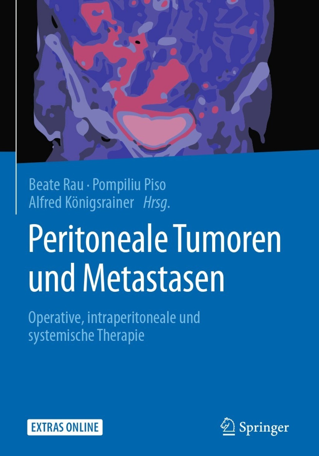 Peritoneale Tumoren und Metastasen Operative, intraperitoneale und systemische Therapie  â€“ PDF/EPUB Version Downloadable