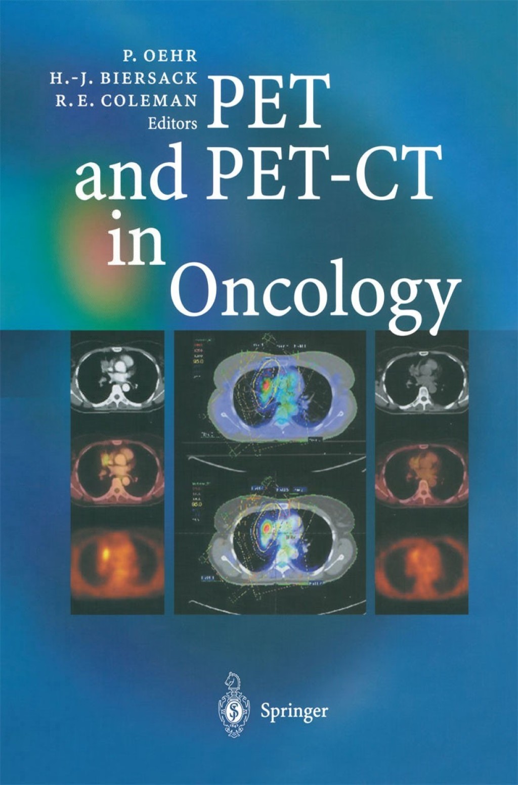 PET and PET-CT in Oncology 1st Edition â€“ PDF/EPUB Version Downloadable