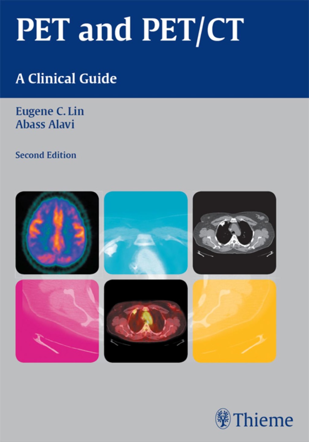PET and PET/CT A Clinical Guide 2nd Edition â€“ PDF/EPUB Version Downloadable