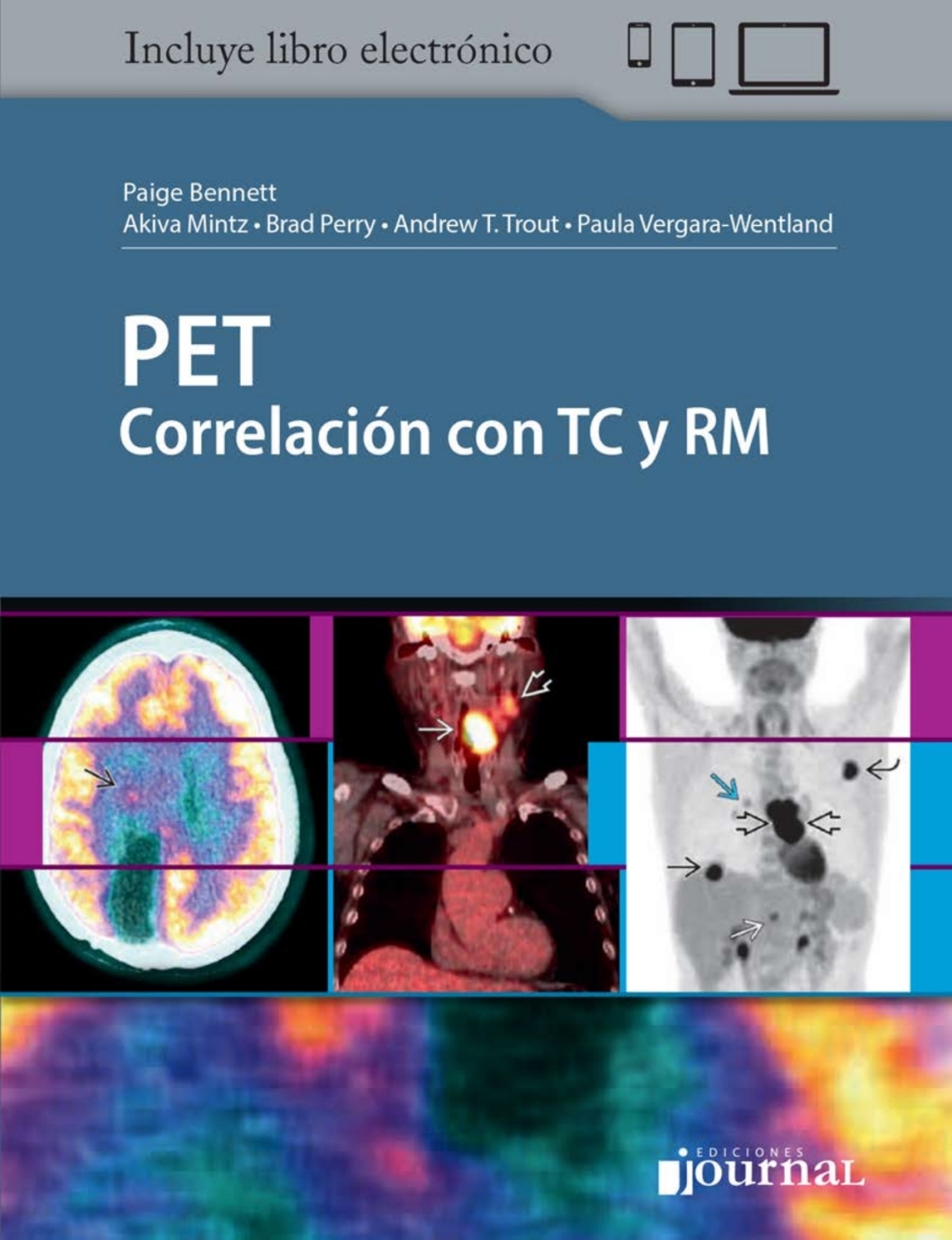 PET: CorrelaciÃ³n con TC y RM 1st Edition â€“ PDF/EPUB Version Downloadable