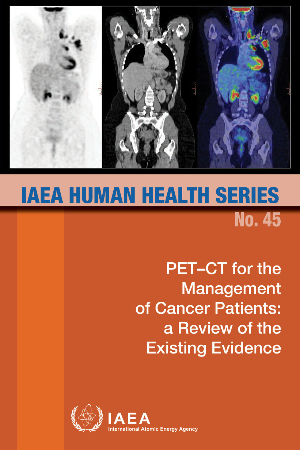 PET-CT for the Management of Cancer Patients A Review of the Existing Evidence  â€“ PDF/EPUB Version Downloadable
